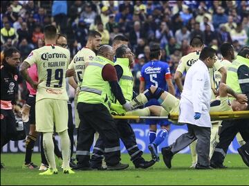 Mateus Uribe sufrió un esguince de tobillo
