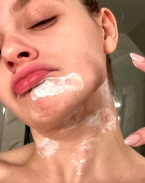 Joe King utilizó una crema para bajar la inflamación. Foto: Instagram oficial.