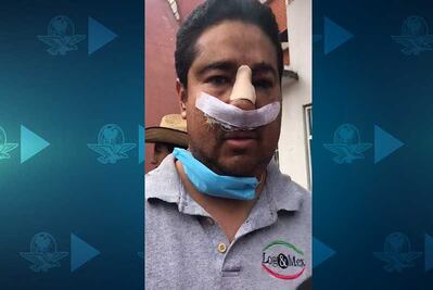 Víctima de presunto abuso policial en San Juanico dice ser elemento de la SSPCDMX