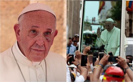 Papa Francisco se golpea el rostro en papamóvil en Colombia
