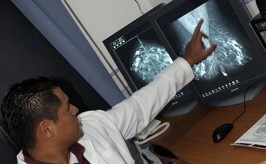 Predicen si quimioterapia servirá antes de emplearla