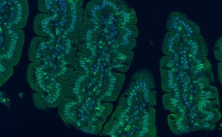 Bacterias intestinales tu mejor aliado para combatir diabetes y estrés