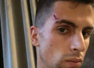Joao Cancelo, jugador del Manchester City, sufre robo en su casa; los ladrones lo lesionaron