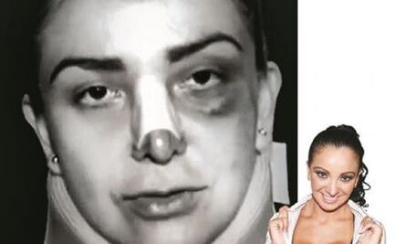 Showbiz personalities shed light on domestic violence