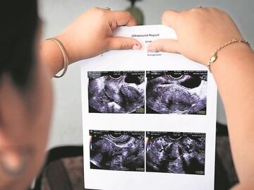 Identifica Segob a mujeres presas por interrupción del embarazo; quedarían en libertad