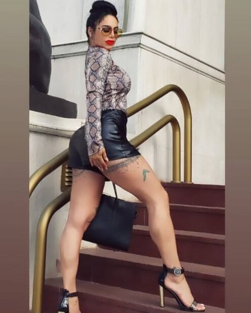 Lis Vega impacta con micro shorts para su procedimiento de labios