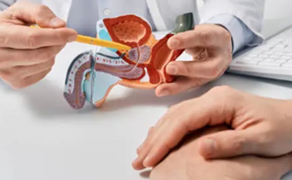 Cáncer de Próstata. Foto: Pixabay