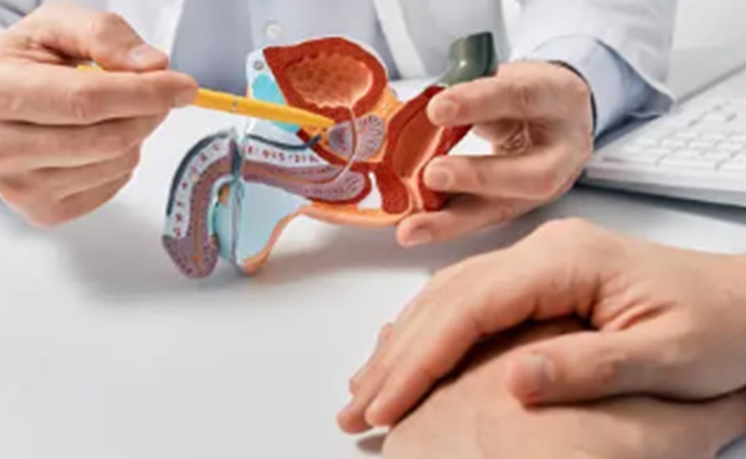 Cáncer de Próstata. Foto: Pixabay