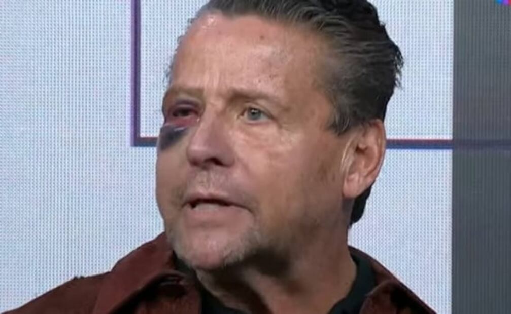 Alfredo Adame asegura que su ojo podría quedar inservible