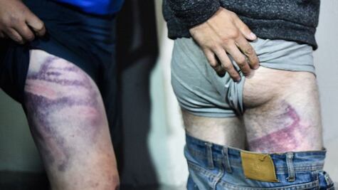 "Solo podían chillar del dolor": los testimonios sobre la brutalidad policial en las protestas en Bielorrusia