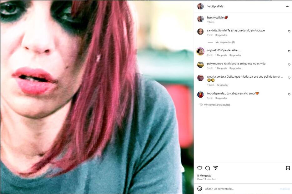 Camilo Blanes, hijo de Camilo Sesto, volvió a prender las alarmas de sus seguidores  tras compartir esta "foto de terror" en la que se evidencia su mal estado físico y mental.