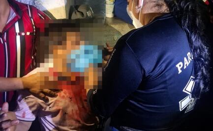 Joven es herido en el rostro con arma deportiva en Yucatán