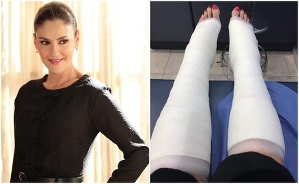 Chantal Andere sufre caída y se fractura los tobillos