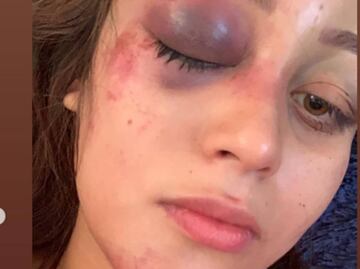 "Si no lograba escaparme, quizás ya no estuviera viva", joven denuncia en redes agresiones de su expareja