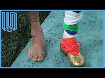 El mensaje de Neymar tras su lesión que pone en riesgo su continuidad en Qatar 2022