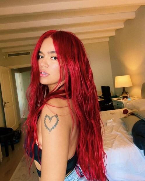 Karol G: la mala experiencia que pasó la Bichota en el quirófano