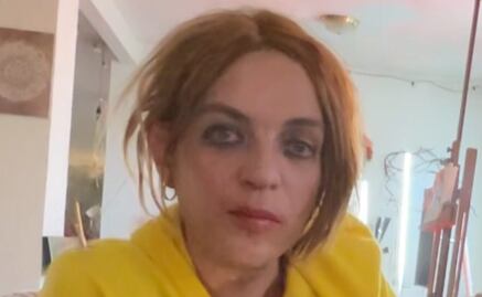 Hijo de Camilo Sesto muestra en video un año de decadencia: foto de sus piernas heridas alerta a fans