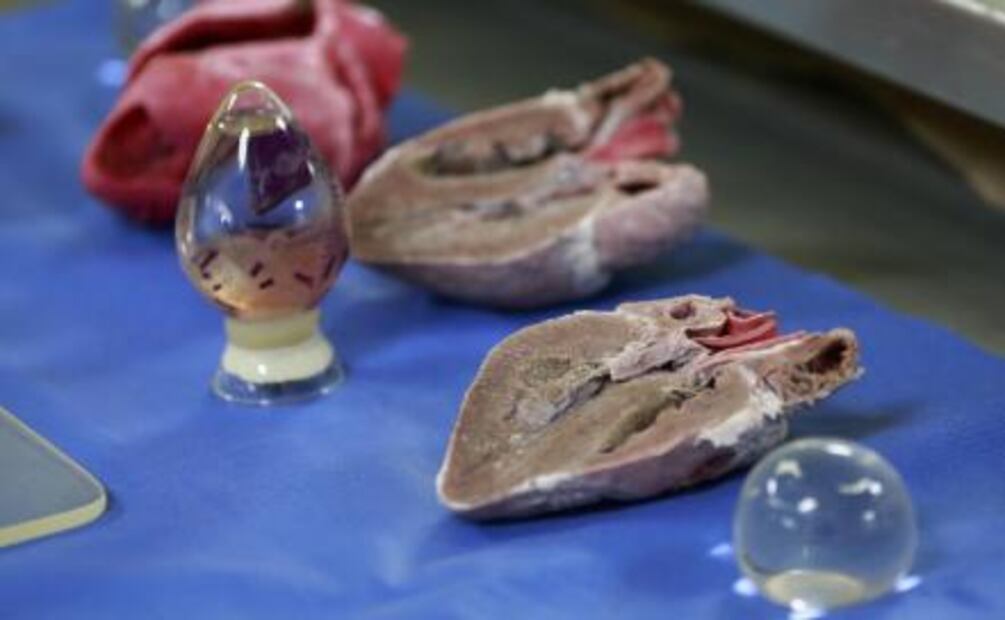 Donar el cuerpo, una opción para salvar vidas después de la muerte