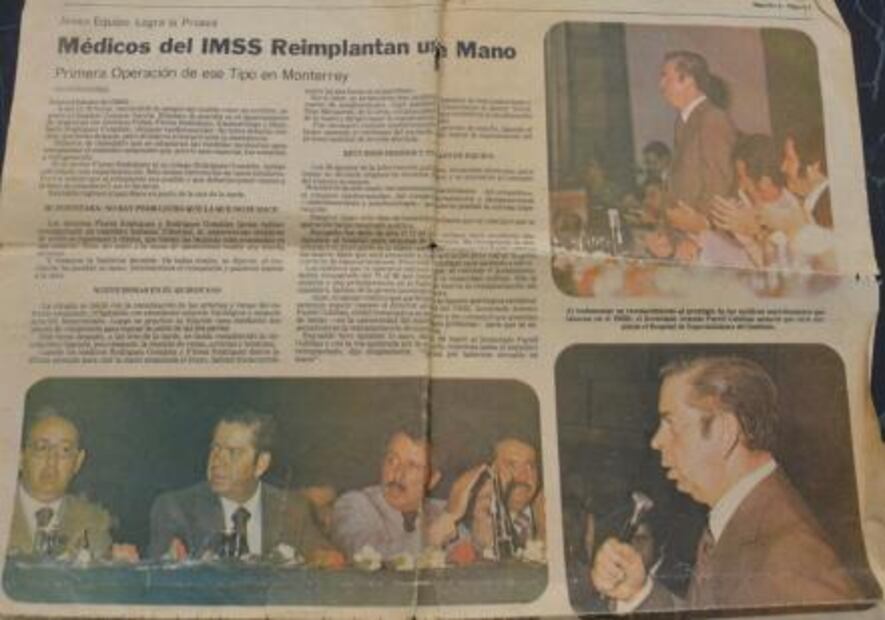Proeza: 41 años del primer reimplante de mano 