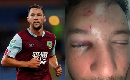 Futbolista de la Premier League recibió golpiza en Manchester