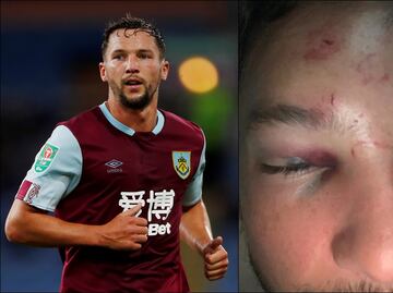 Futbolista de la Premier League recibió golpiza en Manchester