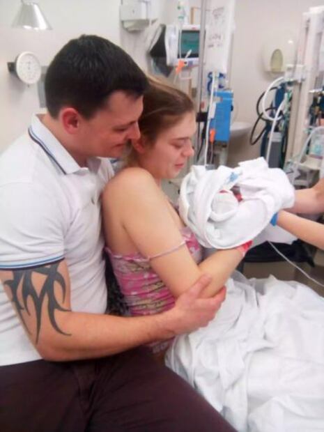 Mujer muestra cómo su bebé prematura nació con la piel roja y casi transparente
