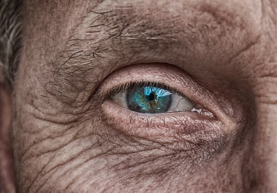 La degeneración macular no tiene cura. Foto: Pixabay