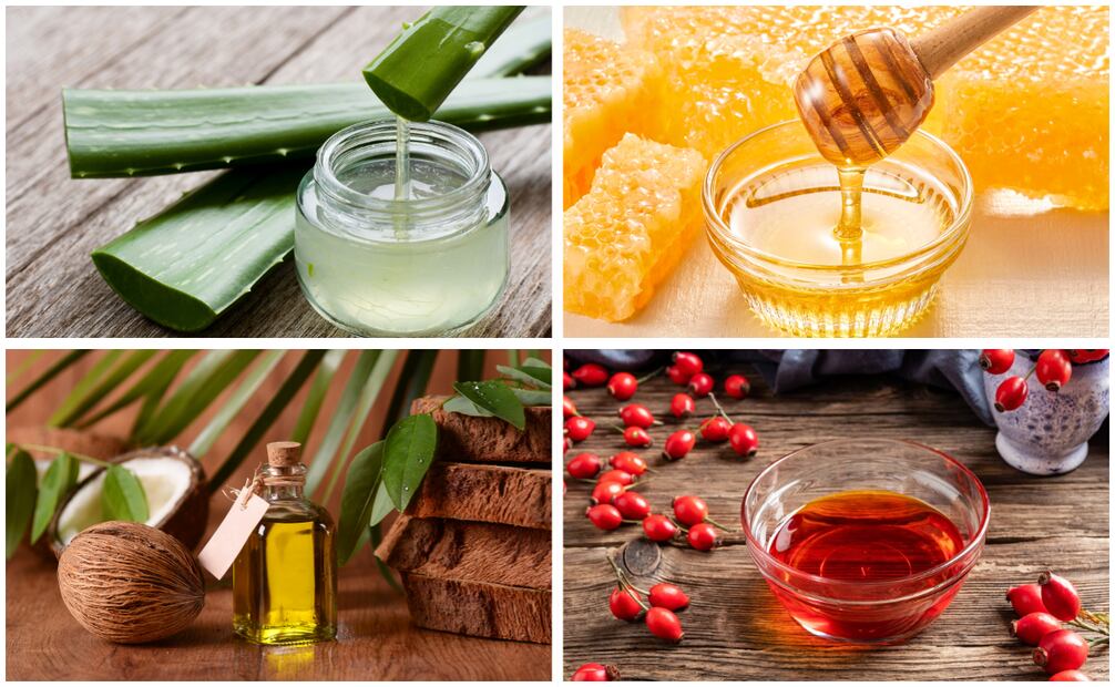 El aloe vera, la miel, el aceite de coco y el aceite de semilla de rosa mosqueta son algunos remedios naturales para combatir las marcas causadas por el acné. Foto: Canva