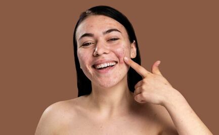 Olvídate de las manchas de la cara con este aceite que seguro tienes en tu cocina