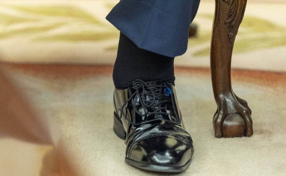 Diagnostican a Trump con insuficiencia venosa crónica tras hinchazón de tobillos. Foto: AP