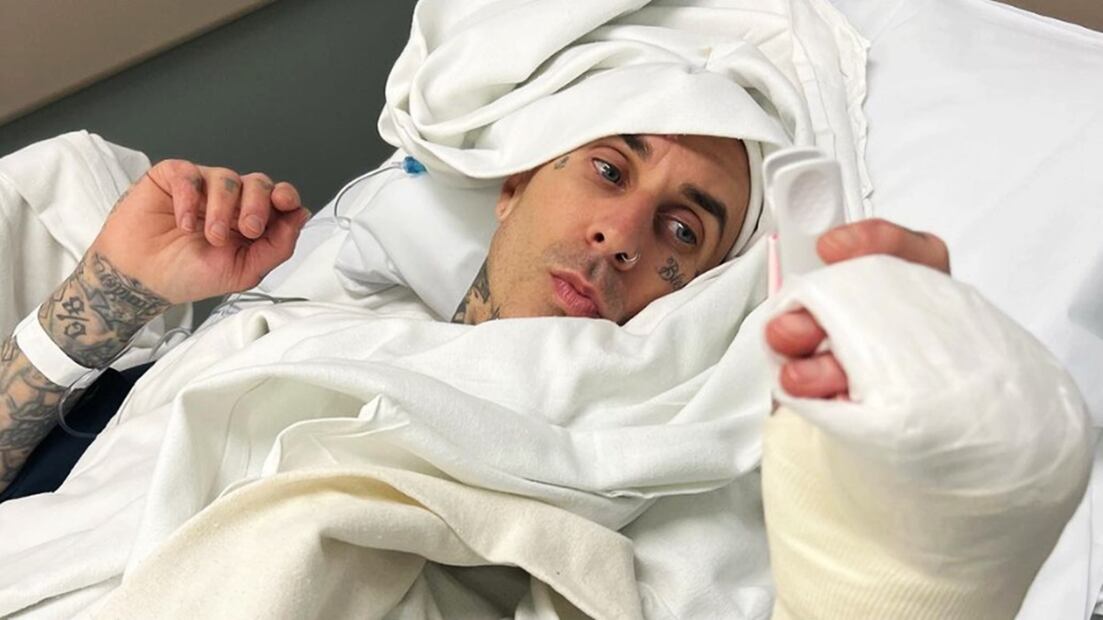 El baterista de la banda, Travis Barker, se fracturó el dedo anular en marzo de este año, motivo por el que la banda pospuso los conciertos que ofrecería en México ese mismo mes.
Foto: Instagram, vía @blink182