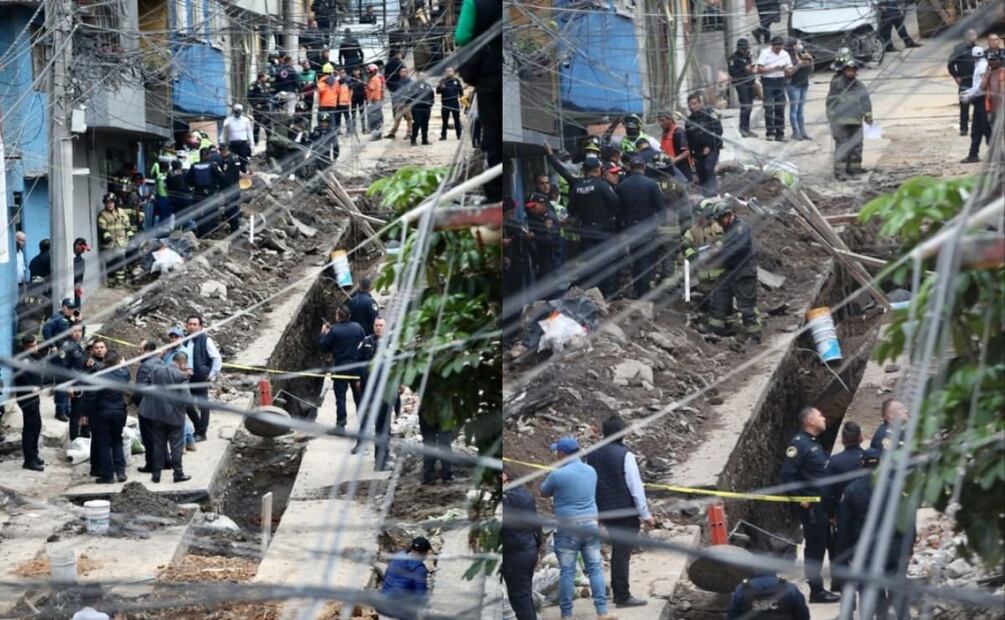 Domingo Sánchez, de 50 años, resultó herido con una fractura en la pierna derecha. Foto: Valente Rosas. EL UNIVERSAL