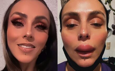 Ivonne Montero aparece con el labio inflamado en redes sociales, ¿qué le sucedió?"