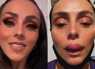 Ivonne Montero aparece con el labio inflamado en redes sociales, ¿qué le sucedió?"