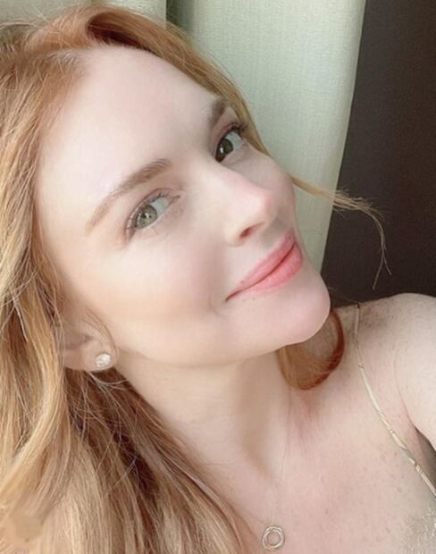 Ricky, Demi, Megan, Lindsay... famosos a quienes las cirugías los dejaron irreconocibles