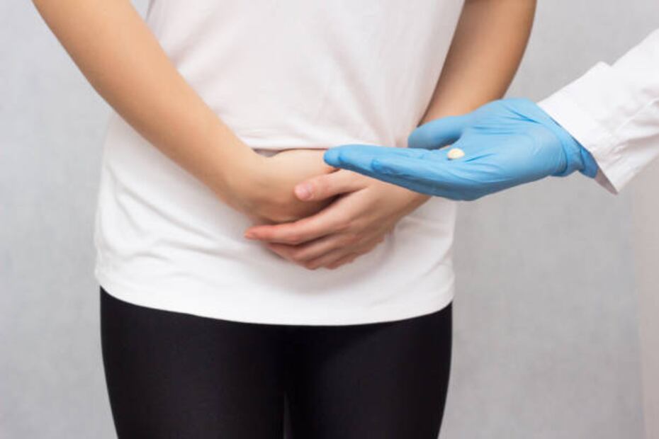 La endometriosis requiere de diagnóstico médico para su tratamiento. Foto: Pixabay