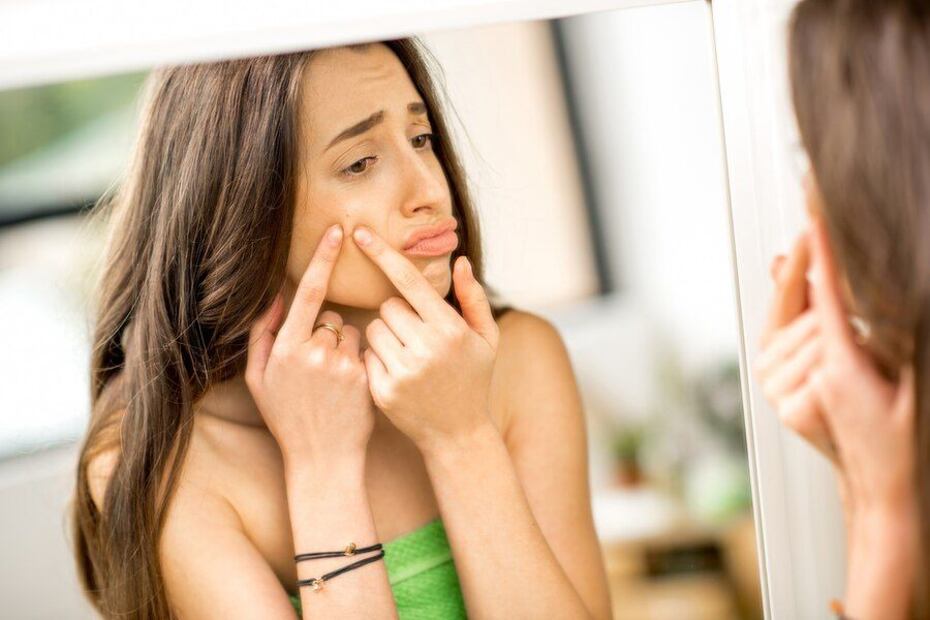 Lidiando con el acné. Fuente: Freepik.