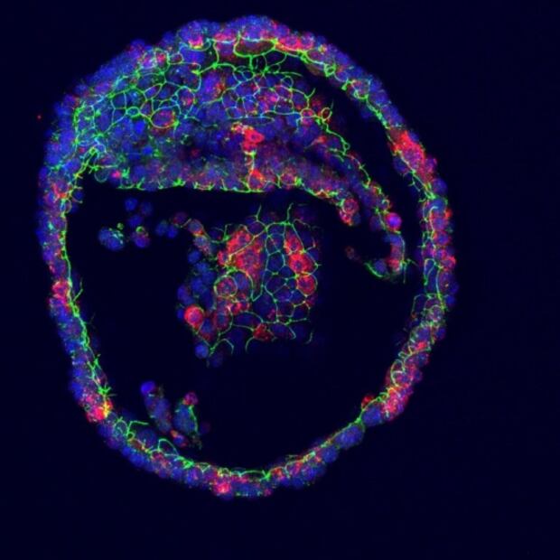 Nuevo logro científico: Investigadores consiguen que células artificiales produzcan lagrimas