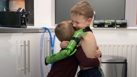 El tierno abrazo de un niño de 5 años a su hermano tras recibir una prótesis de brazo en Inglaterra 
