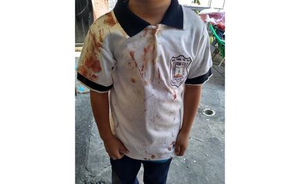Alumno regresa ensangrentado de la primaria “por bullying” en Morelos