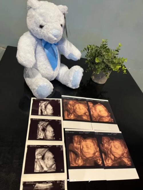 Ecografía de Sarah-Jayne Snow, la mujer que busca al padre de su hijo. FOTO: TIKTOK @sarah.jayne.snow