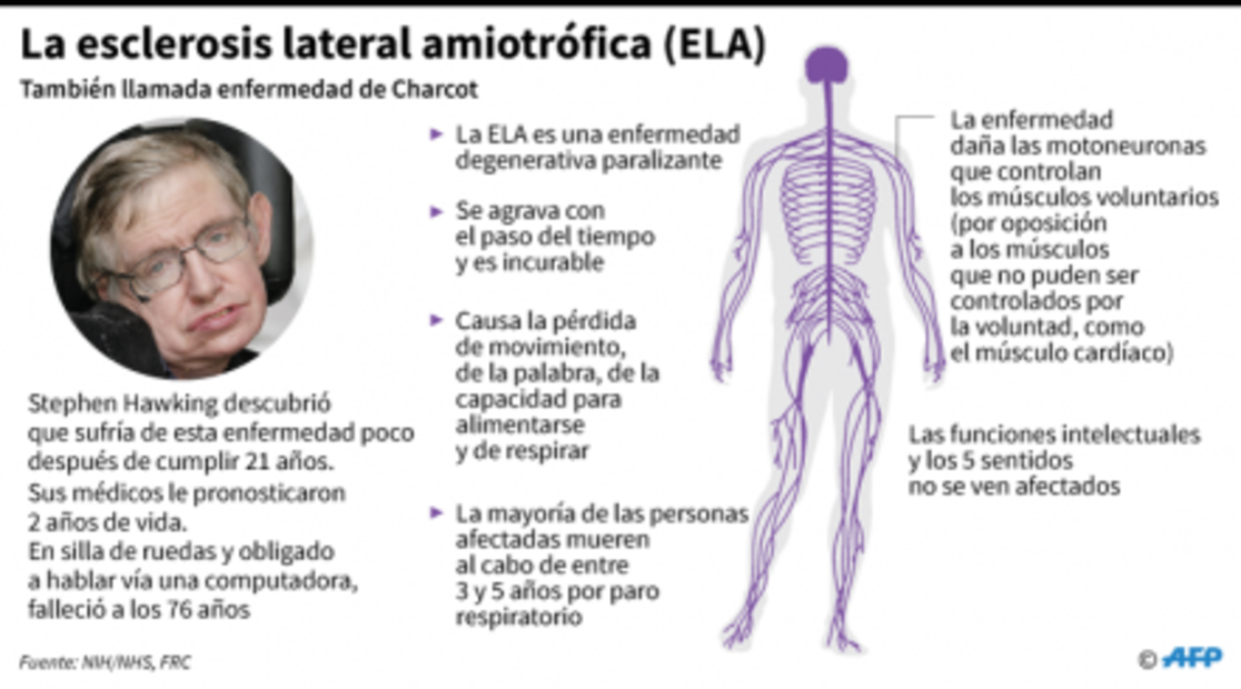 ¿Qué es la enfermedad de Charcot que padecía el físico Stephen Hawking?