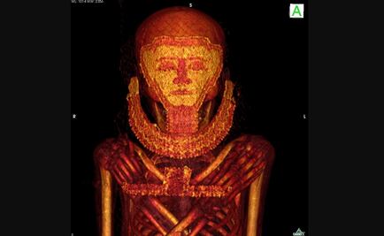 Momias de egipto también tuvieron cáncer de mama