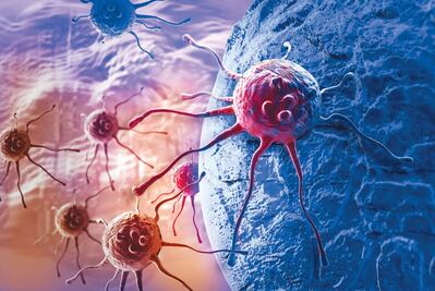 Entérate. ¿Qué es el cáncer?