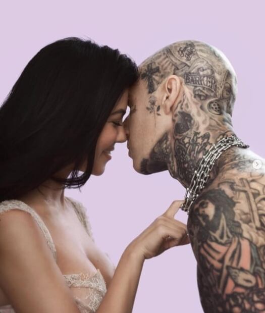 ¿Y la gira de Blink-182?, Travis Barker publica una foto de su dedo fracturado