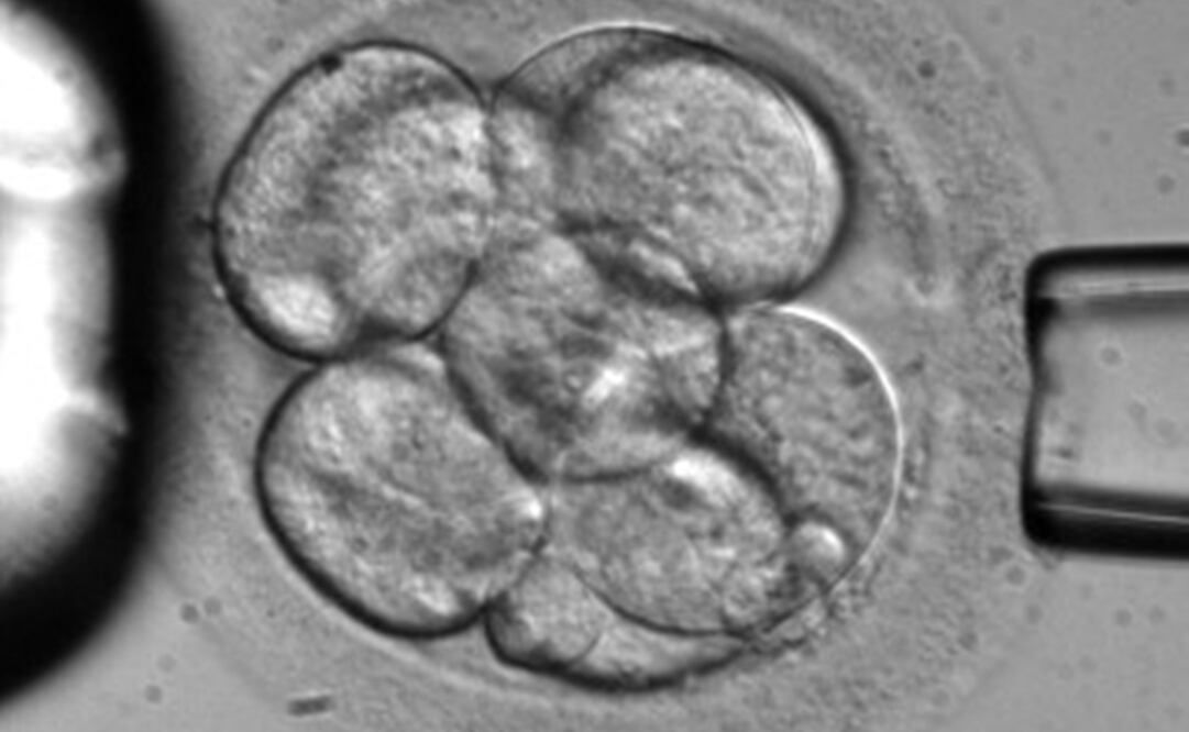 Una célula es removida de un embrión. Foto: AP/Advanced Cell Technology, archivo