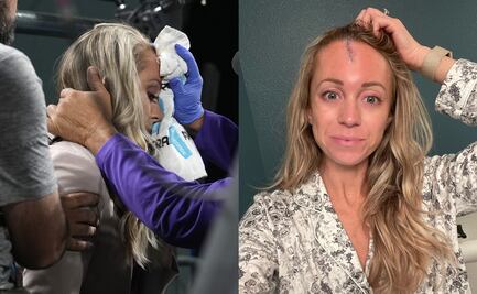 Reportera de los Rockies recibe pelotazo que iba a 150 km por hora