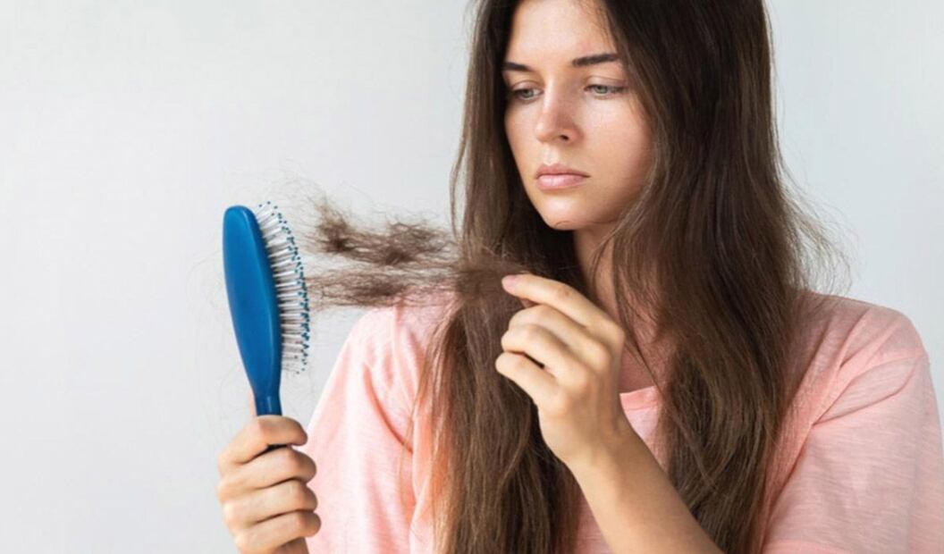 Caída de cabello. Foto: Pexels