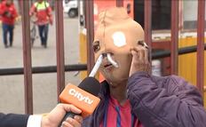 "Ya son 26 años con el rostro así"; María Consuelo, víctima de ataque con ácido en Colombia, contempla la eutanasia