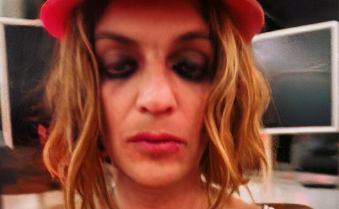 Camilo Blanes, hijo de Camilo Sesto, en crisis por sus adicciones. Desde hace meses, el cantante comparte fotos y videos de su decadente estilo de vida. Foto: Instagram hercitycallale